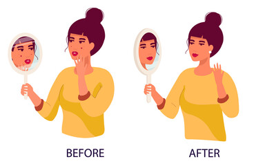 Stem cell for acne scar results